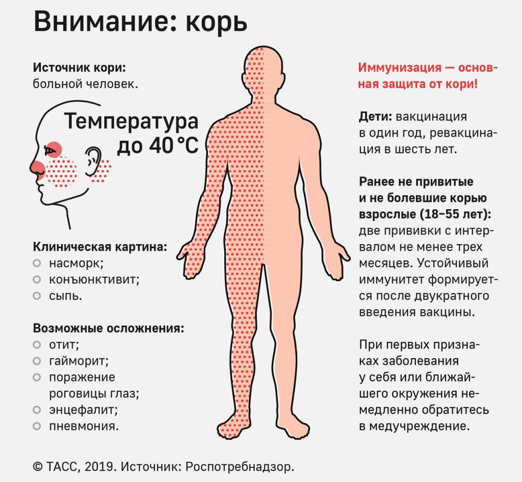 Роспотребнадзор назвал число заболевших корью в России