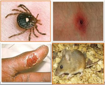 Туляремия - зоонозная природно-очаговая бактериальная инфекционная болезнь с несколькими путями передачи возбудителя.